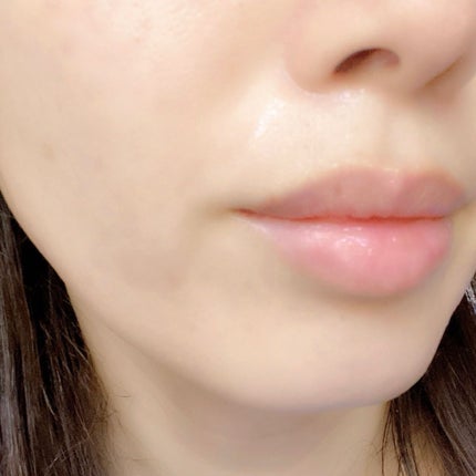 ブライトニングピーリングジェル/Dr.G/ピーリングを使ったクチコミ(5枚目)