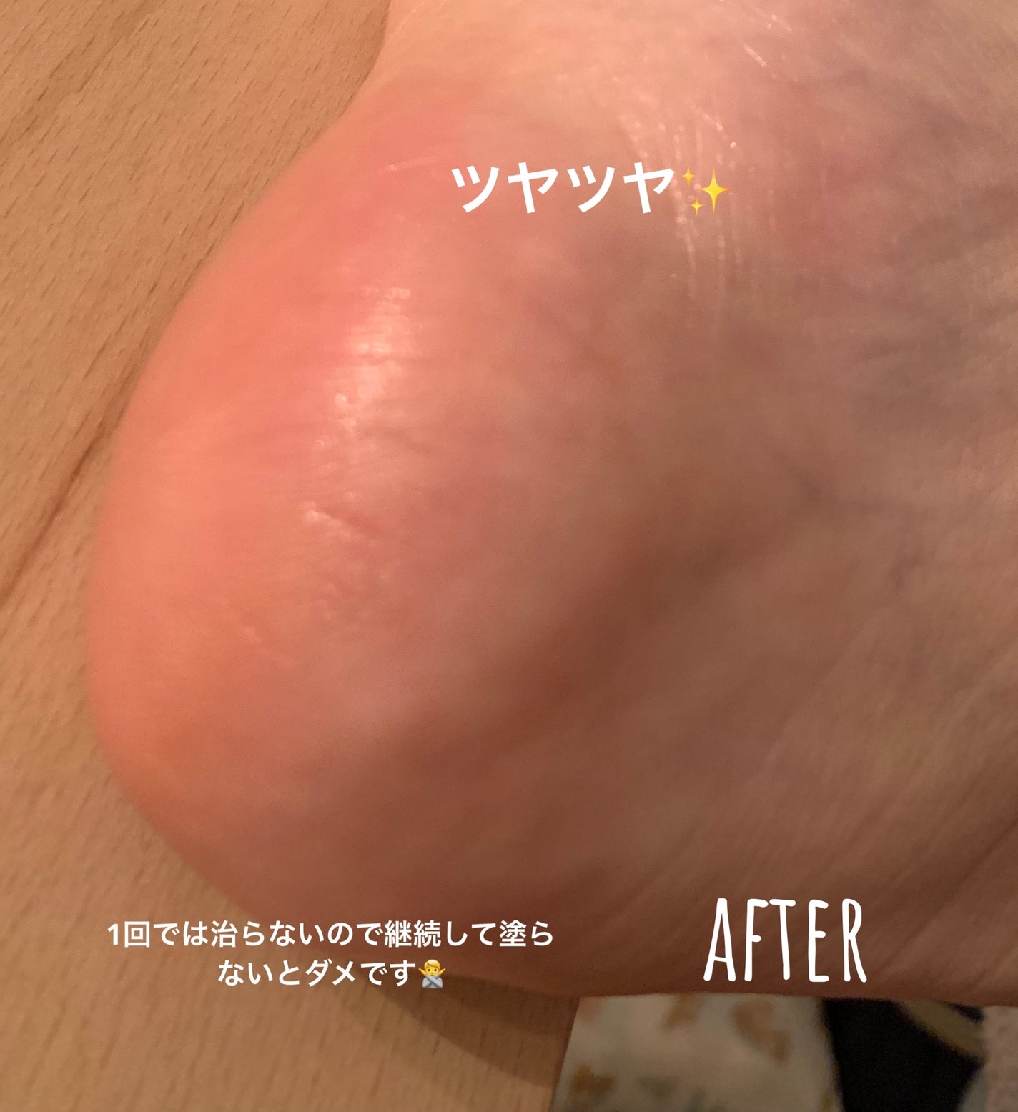 ゴウンバル クリーム/3WB/レッグ・フットケアを使ったクチコミ(3枚目)