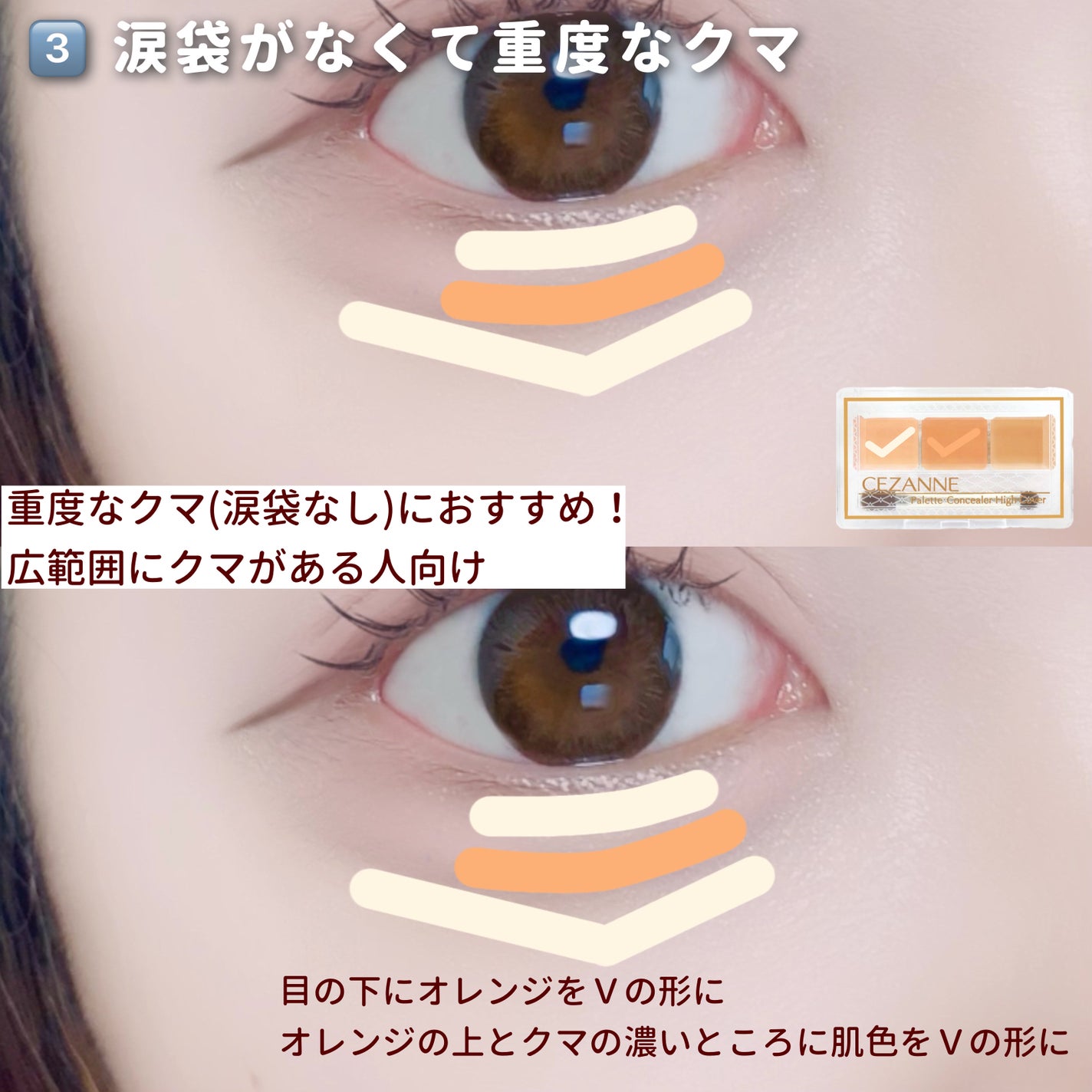 カラーミキシングコンシーラー/キャンメイク/パレットコンシーラーを使ったクチコミ(4枚目)