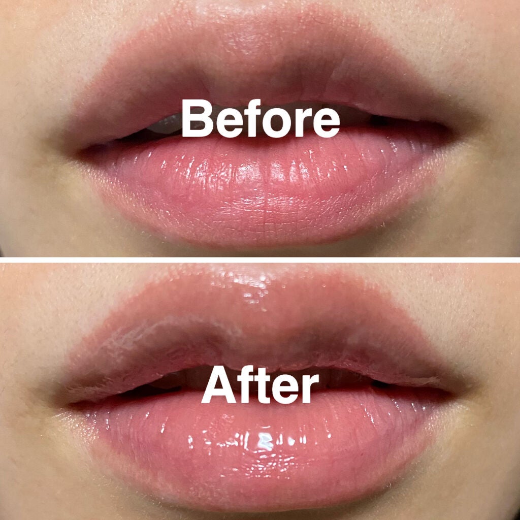 PLIFT VPリップ 唇用美容液 4個セット