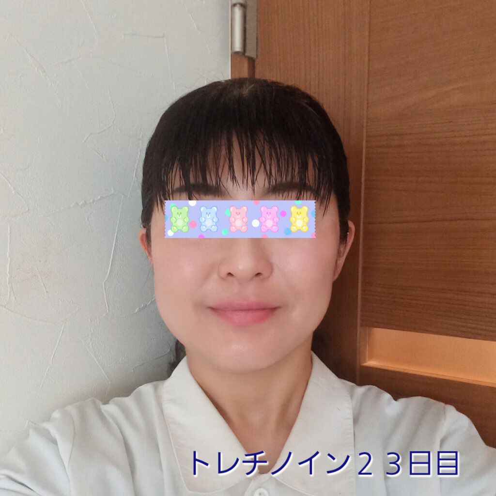 リンクルシートマスク Ｎ/なめらか本舗/シートマスク・パックを使ったクチコミ（1枚目）