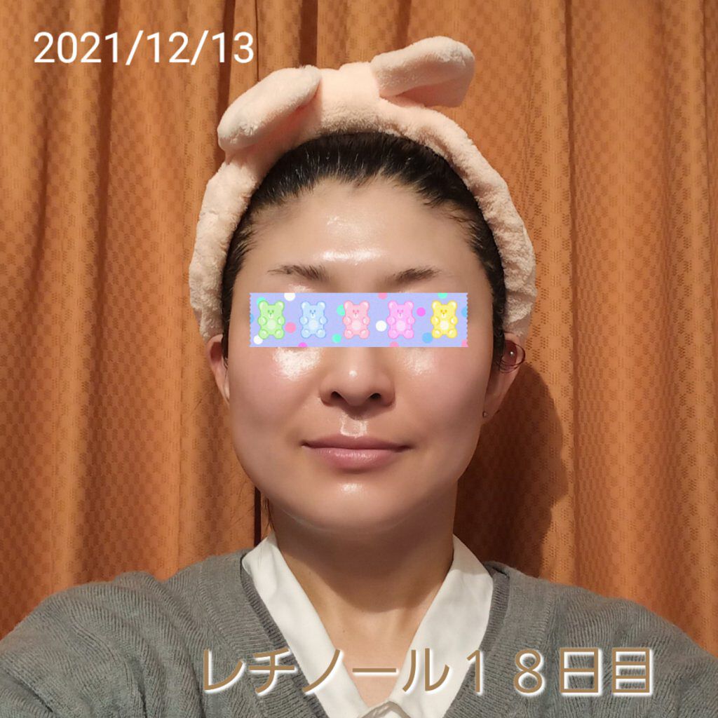 モイスチャーバーム ジャー/キュレル/フェイスクリームを使ったクチコミ（1枚目）