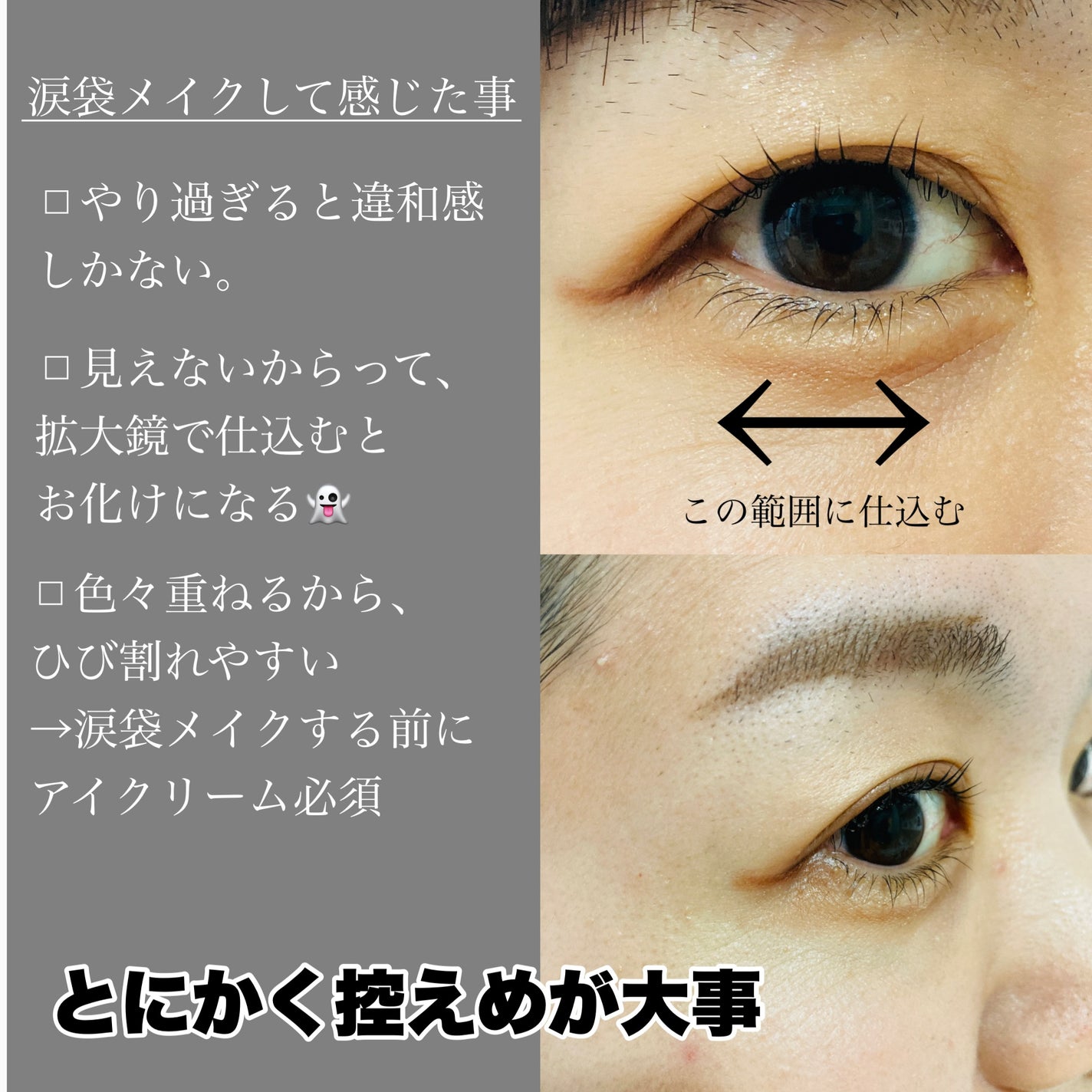 金のプラセンタもっちり白肌濃シワトール/ホワイトラベル/アイケア・アイクリームを使ったクチコミ(1枚目)