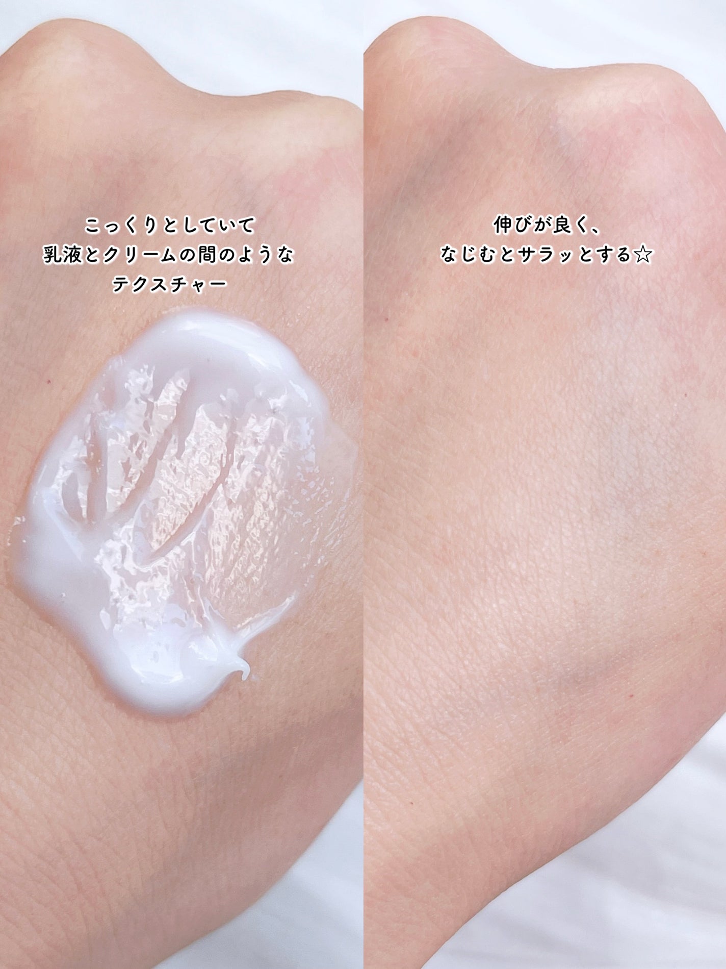 ã»ã¿ãã£ã« ã¢ã€ã¹ãã£ã©ã€ãžã³ã°ããŒã·ã§ã³/ã»ã¿ãã£ã«/ããã£ããŒã·ã§ã³ã䜿ã£ãã¯ãã³ãïŒ3æç®ïŒ