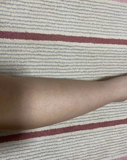 ブラウンシルクエキスパート (光美容器)/ブラウン/家庭用脱毛器を使ったクチコミ(1枚目)