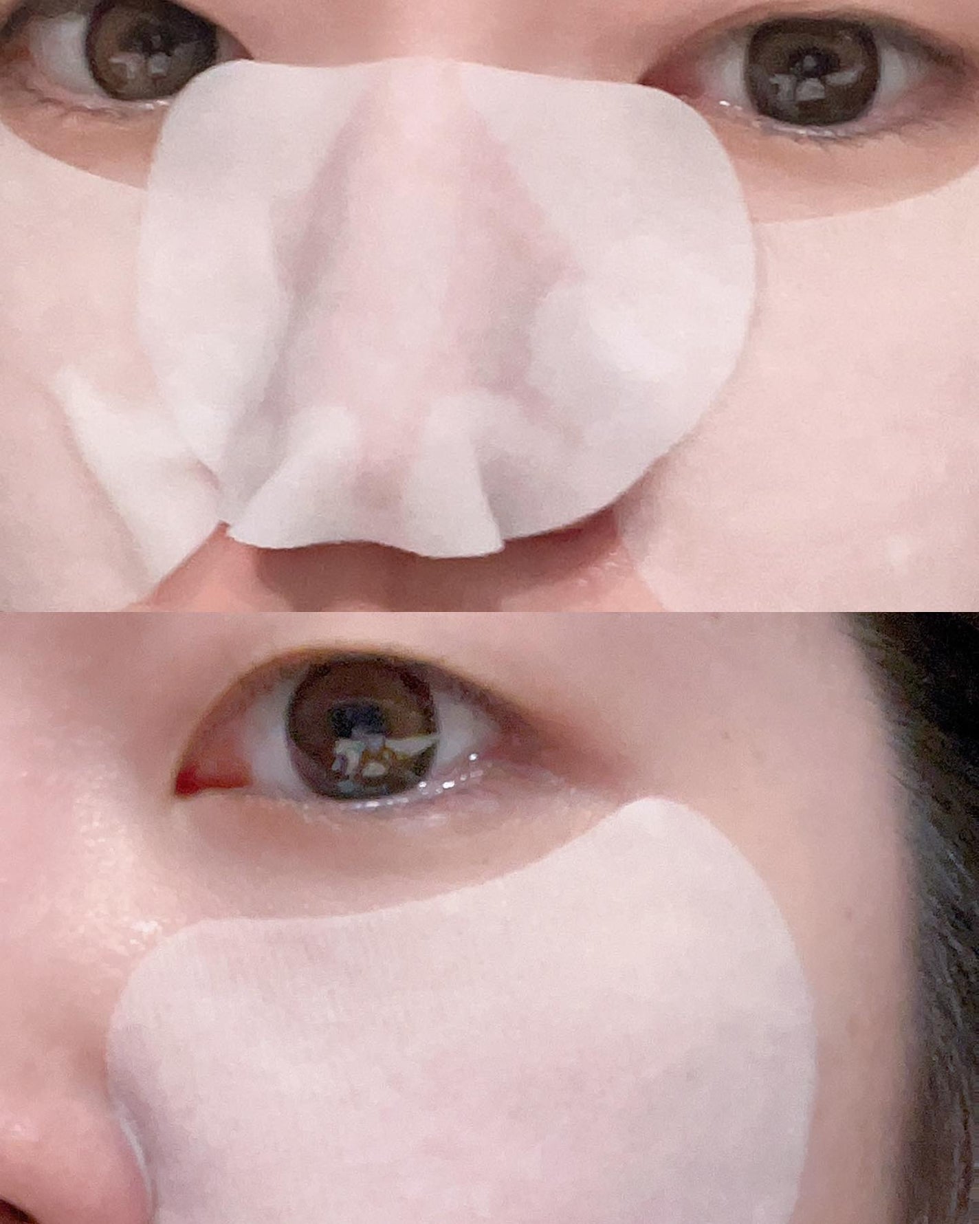 カーミングリペア若葉のシカスポットパッド/Luvum/トナーパッドを使ったクチコミ(8枚目)