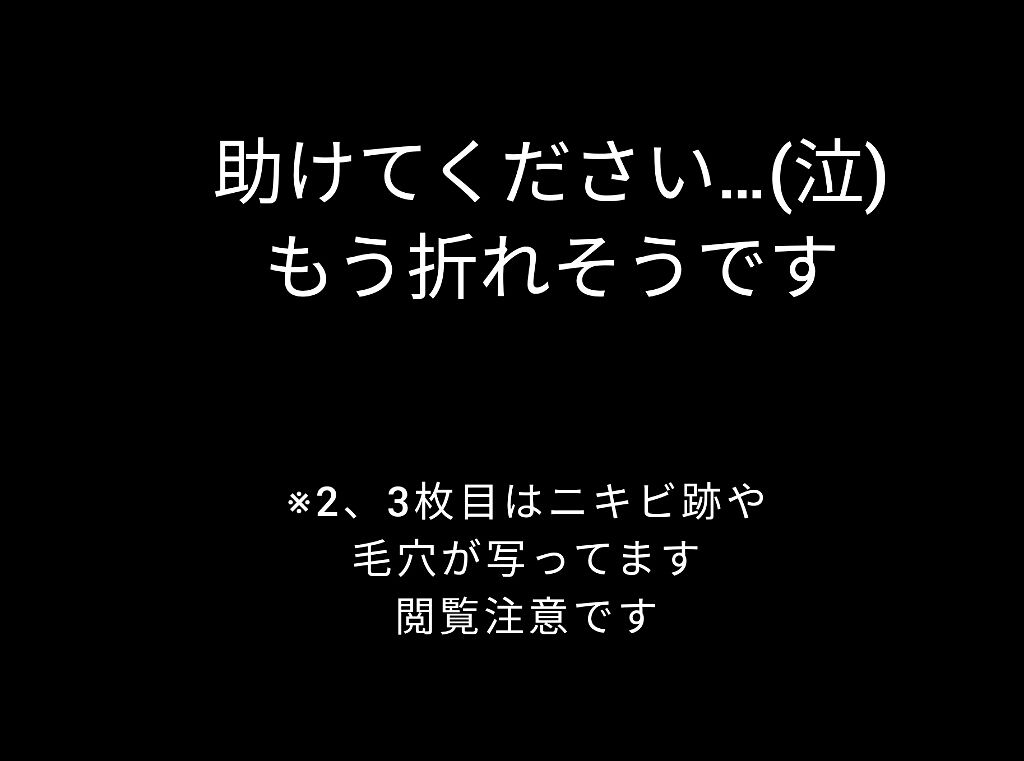 ハトムギ化粧水(ナチュリエ スキンコンディショナー R )/ナチュリエ/化粧水を使ったクチコミ（1枚目）