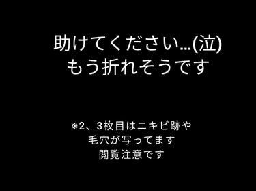 ハトムギ化粧水(ナチュリエ スキンコンディショナー R )/ナチュリエ/化粧水を使ったクチコミ（1枚目）