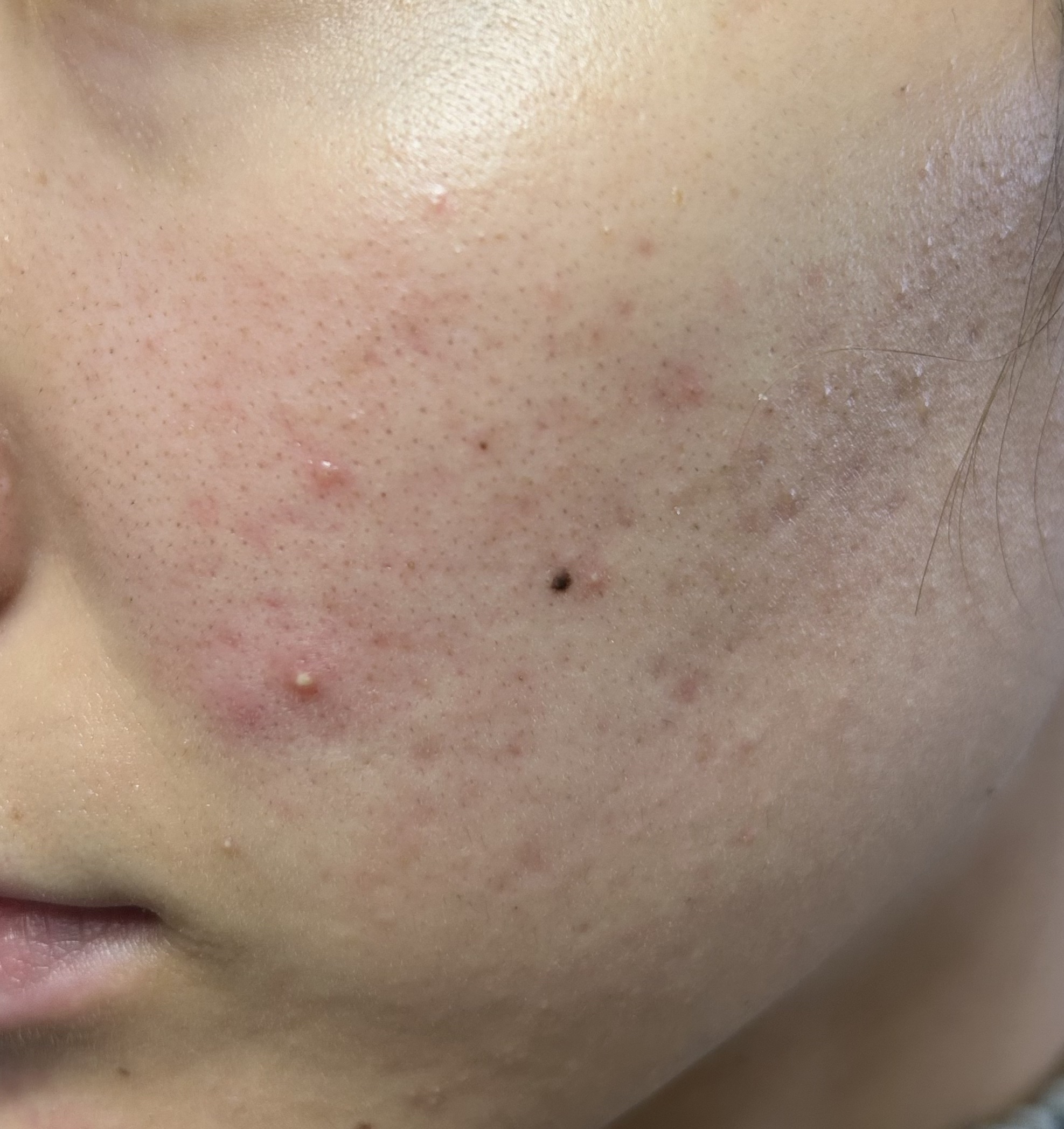 グリーンダーマCICA デイリーシートマスク/ネイチャーリパブリック/シートマスク・パックを使ったクチコミ（3枚目）