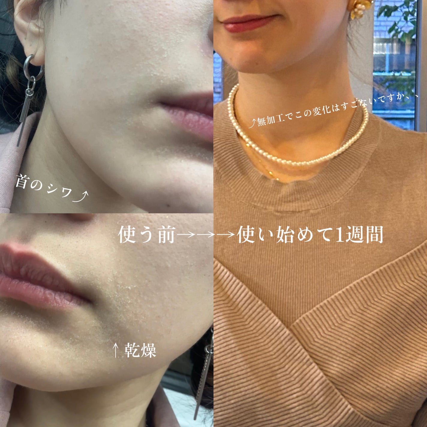 ドクダミ 77 スージングトナー/Anua/化粧水を使ったクチコミ(5枚目)