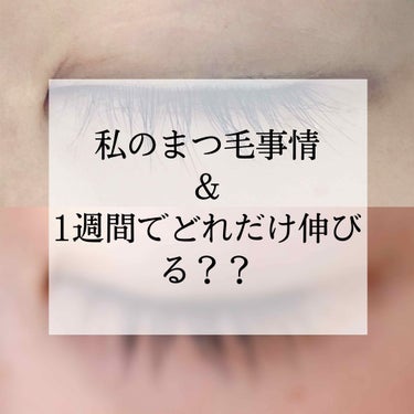 【私のまつ毛事情と1週間の検証】
今回は私が大切にしているまつ毛のケア方法とその1週間検証をを紹介していきます！ 




私はダイソーのRJローションという美容液でまつ毛ケアをしています
この美容液は