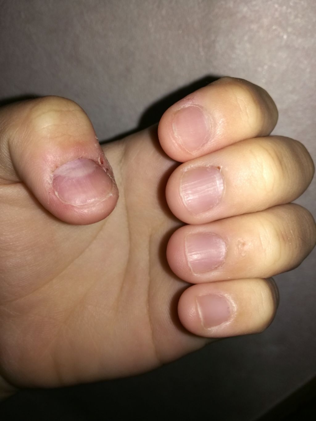 AC キューティクルオイル/AC MAKEUP/ネイルオイル・トリートメントを使ったクチコミ(2枚目)