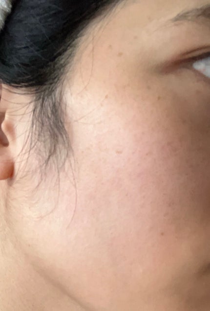 ブレミショット美容液/AMPLE:N/美容液を使ったクチコミ(10枚目)