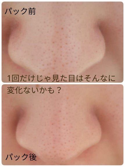 スチーマー ナノケア EH-SA35/Panasonic/美顔器・マッサージを使ったクチコミ(3枚目)