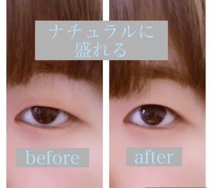 アイビューティー フィクサー WP/アストレア ヴィルゴ/二重まぶた用アイテムを使ったクチコミ(5枚目)