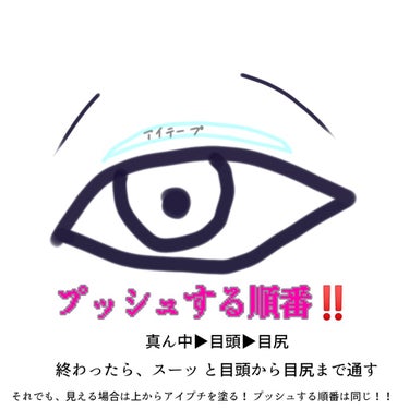 ワンダーアイリッドテープ Extra/D-UP/二重まぶた用アイテムを使ったクチコミ（2枚目）