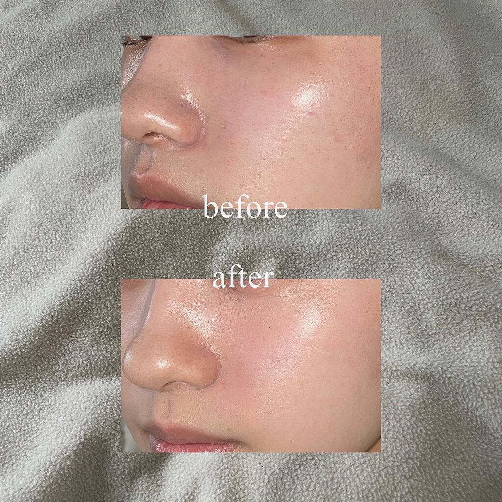 密着カバーファンデーション 21 ライトベージュ/GIVERNY/リキッドファンデーションを使ったクチコミ（3枚目）