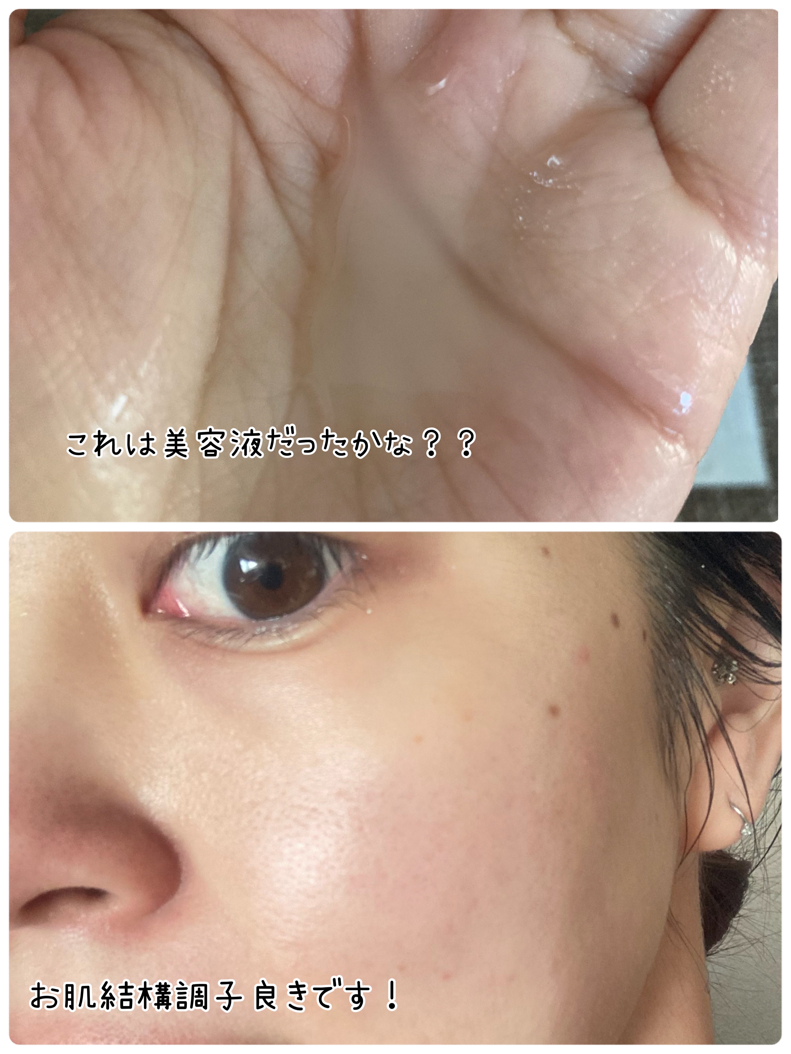 オーガニックオメガチャージ/MiMC/美容液を使ったクチコミ（3枚目）