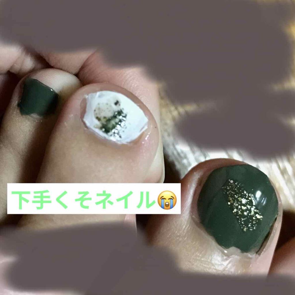 サンリオネイル/DAISO/マニキュアを使ったクチコミ(2枚目)