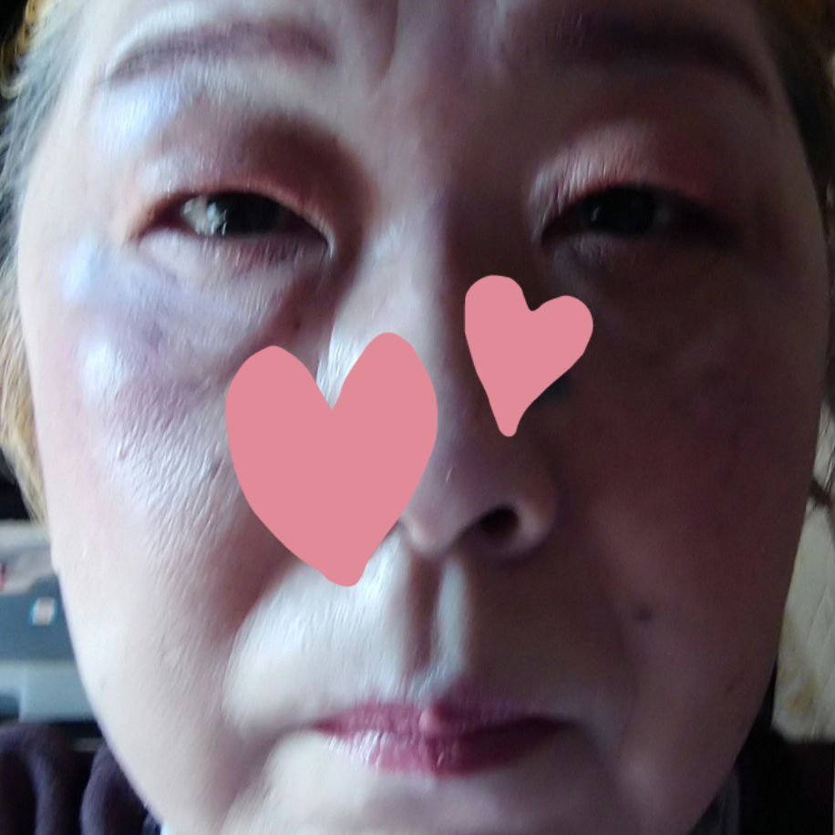 ケイト リップモンスター/KATE/口紅を使ったクチコミ（3枚目）