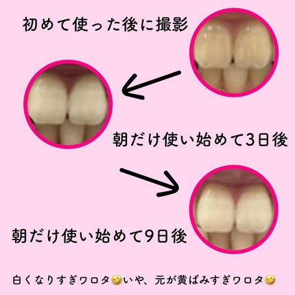 ホワイトニング美白歯磨き粉/EUTHYMOL/歯磨き粉を使ったクチコミ(6枚目)