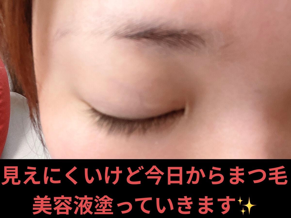 ラッシュアディクト アイラッシュコンディショニングセラム/soaddicted/まつげ美容液を使ったクチコミ(1枚目)