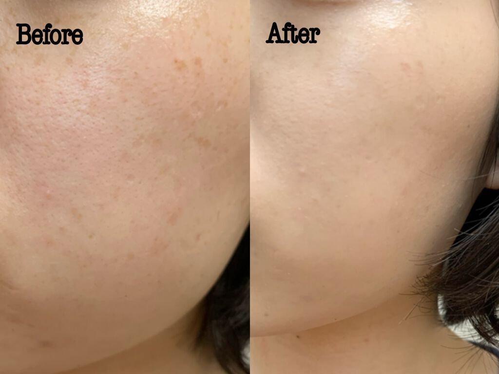 CICAレッドネスカバークッション/VT/クッションファンデーションを使ったクチコミ（3枚目）