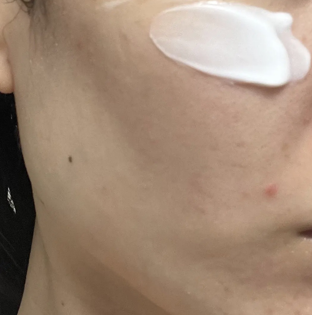 シカリニック PSL クリーム/CICALINIC/フェイスクリームを使ったクチコミ（3枚目）