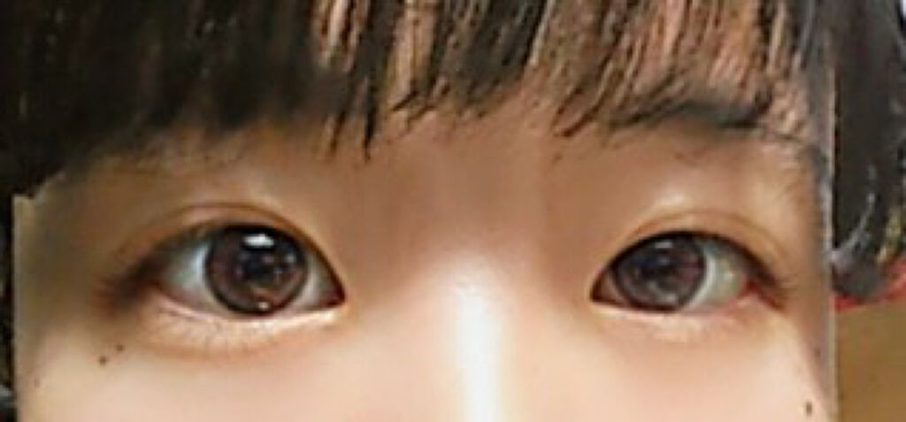 アイビューティー フィクサー WP/アストレア ヴィルゴ/二重まぶた用アイテムを使ったクチコミ(3枚目)