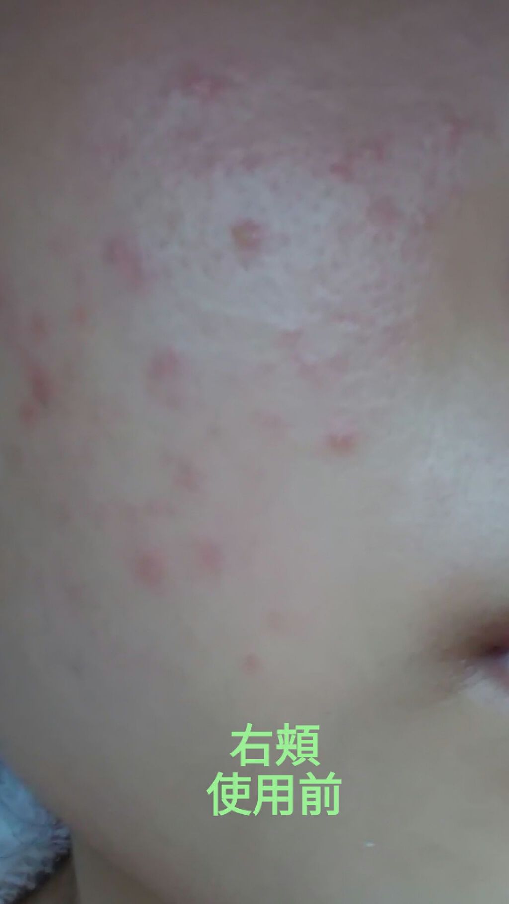 ティーツリーケアソリューション アンプルマスクJEX/MEDIHEAL/シートマスク・パックを使ったクチコミ（3枚目）