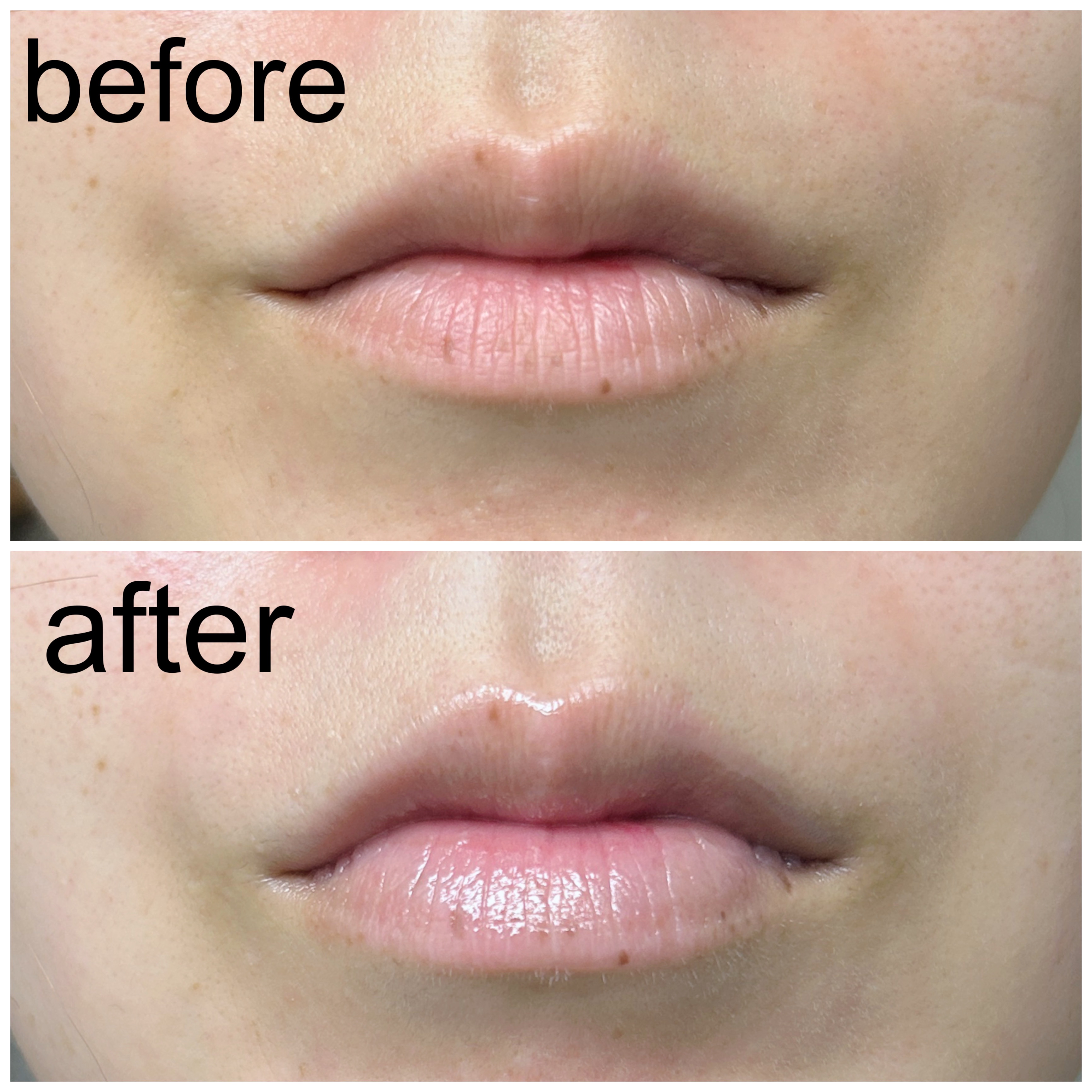 イリュン コラーゲンモイスチャーリップマスク/illuN/リップマスクを使ったクチコミ（2枚目）