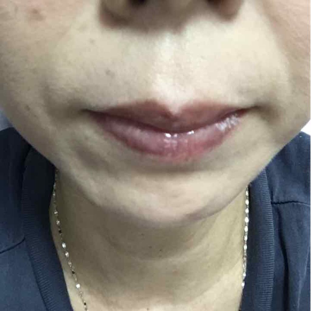 リップグロス ピュア/ADDICTION/リップグロスを使ったクチコミ(3枚目)