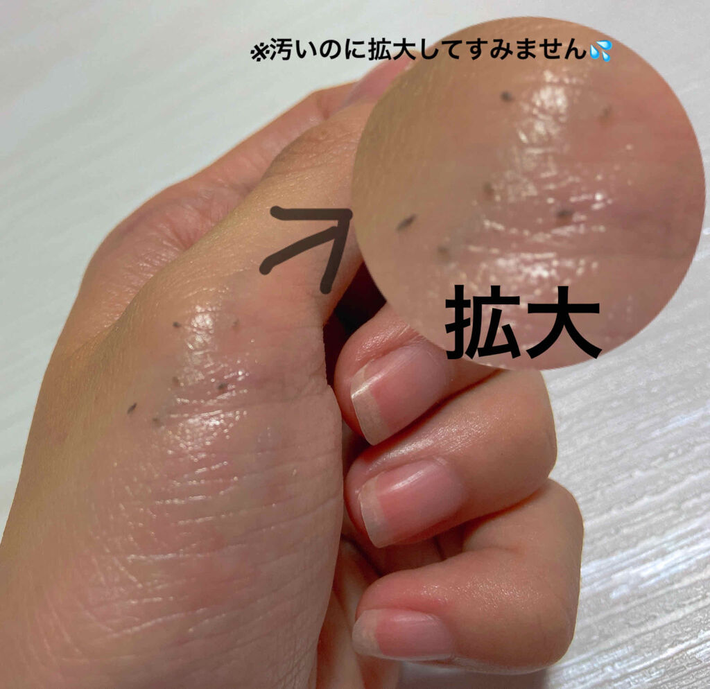 バイオイル/バイオイル/フェイスオイルを使ったクチコミ（3枚目）