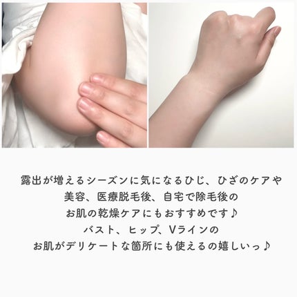 バージンホワイトセラム/べっぴんボディ/ボディクリームを使ったクチコミ(6枚目)