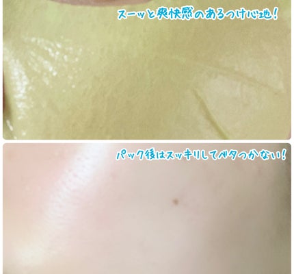 ACコントロールEXディープマスク/DEWYTREE/シートマスク・パックを使ったクチコミ(4枚目)