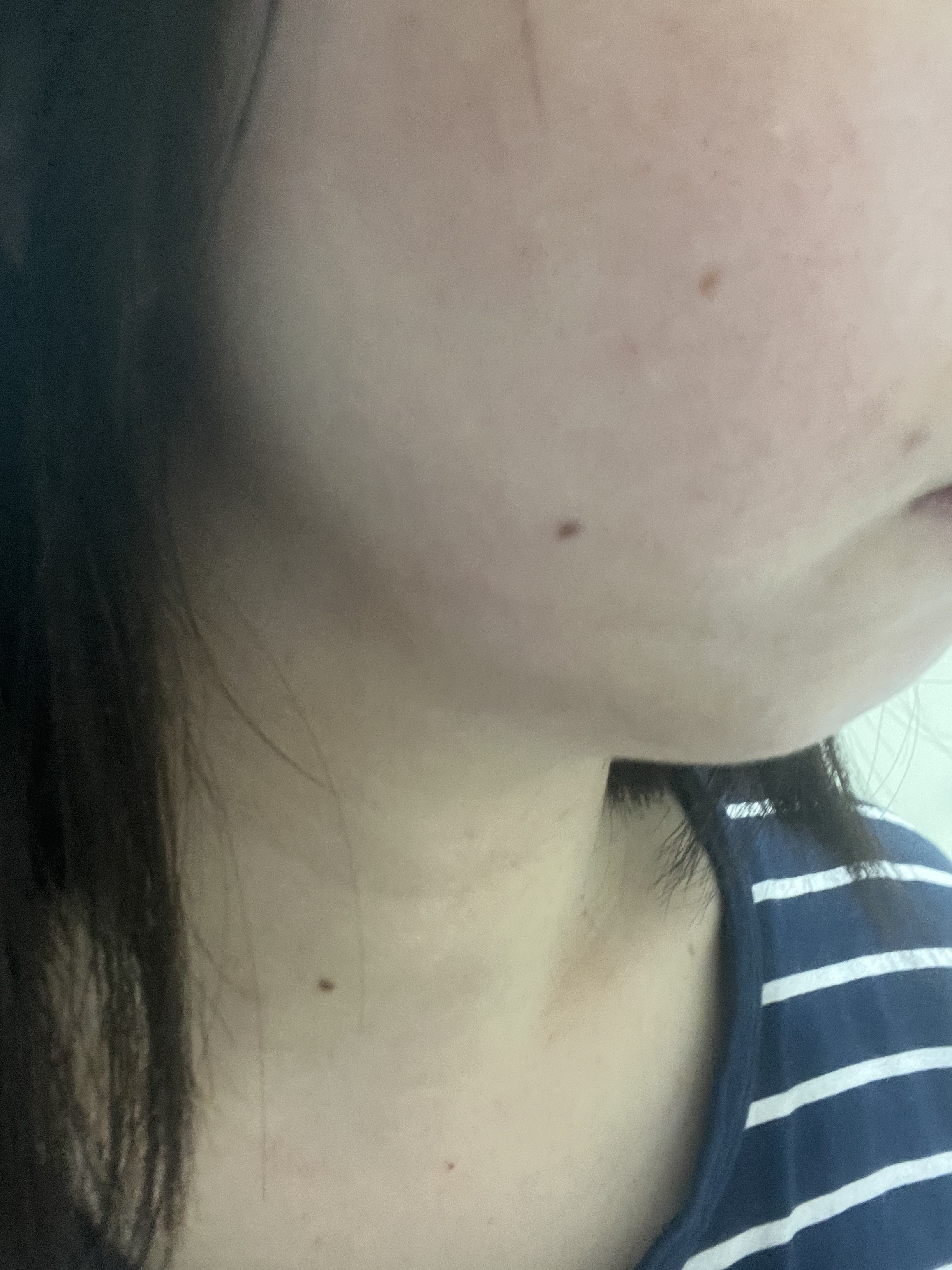 アスハダ-ASHADA-美容液(パーフェクトクリアエッセンス) /アスハダ/美容液を使ったクチコミ（3枚目）