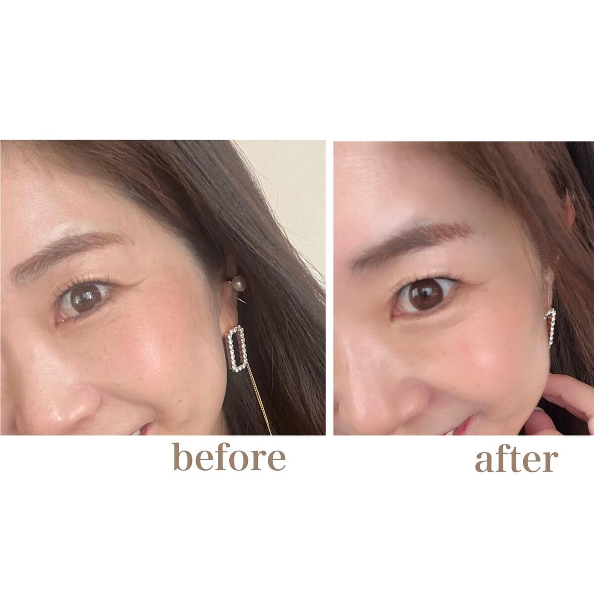 RJ トライアルセット/アピセラピーコスメティクス/スキンケアキットを使ったクチコミ(9枚目)