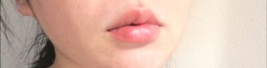 唇のオイルピーリング/リップルン/リップケア・リップクリームを使ったクチコミ（4枚目）