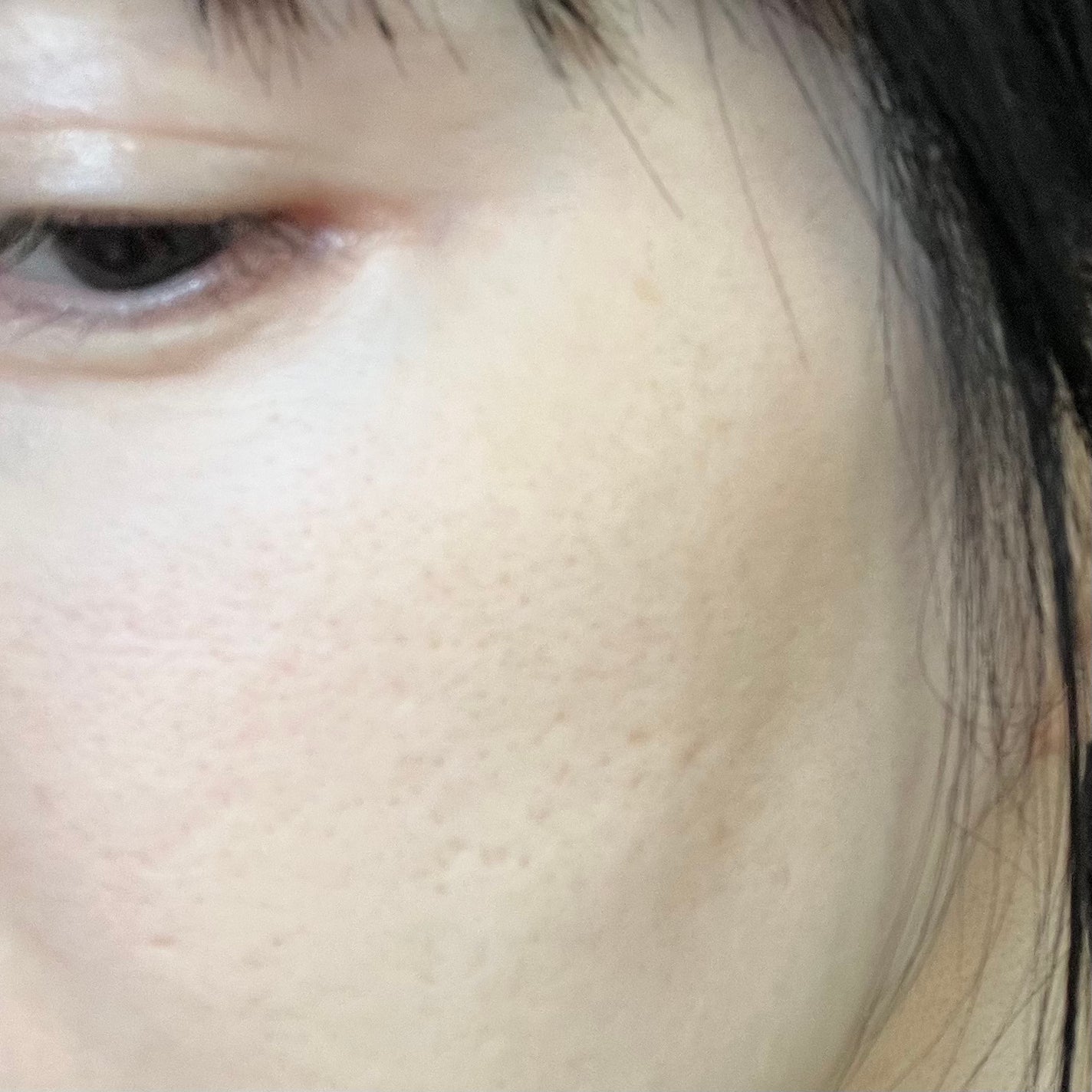 ããðŠçŸå®¹æçš¿ããæ¹ãã©ãã on LIPS ã44æãiPhoneããŒãã«ã«ã¡ã©ãã£ãŽãç¡å å·¥åçããªããŠã..ãïŒ4æç®ïŒ