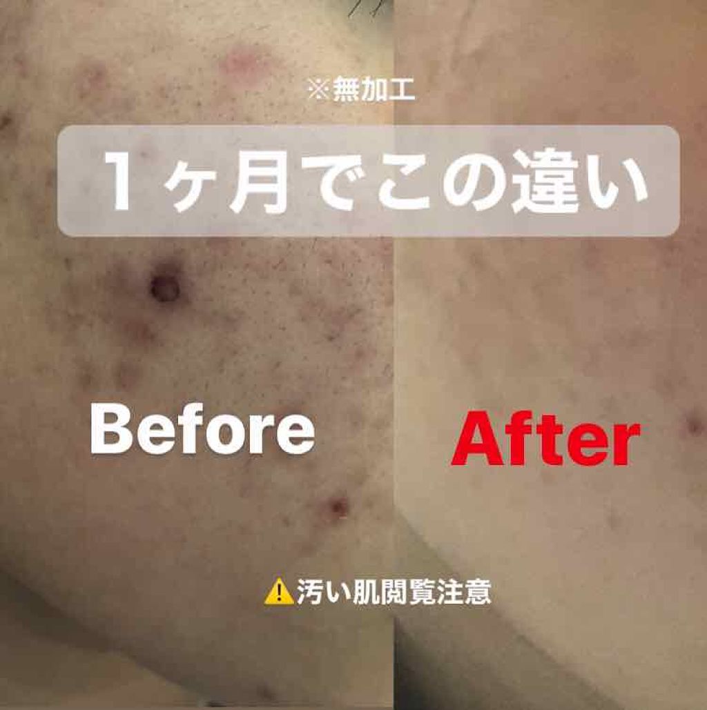 明色美顔水 薬用化粧水/美顔/化粧水を使ったクチコミ（1枚目）