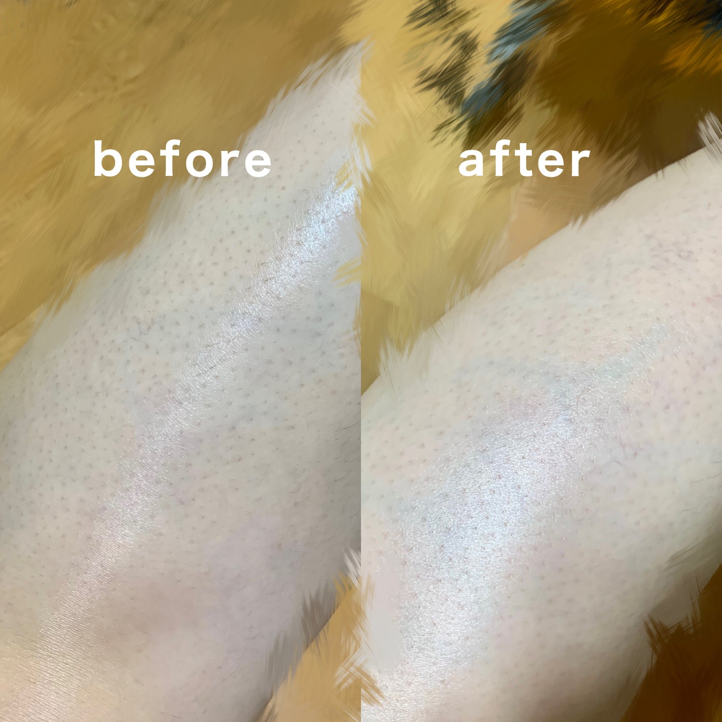 SIPL-1000C 家庭用光美容器/eosika/家庭用脱毛器を使ったクチコミ(3枚目)