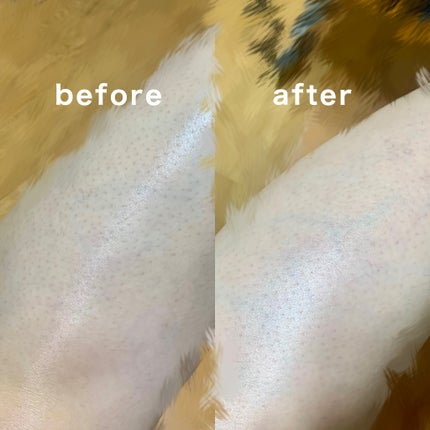 SIPL-1000C 家庭用光美容器/eosika/家庭用脱毛器を使ったクチコミ(3枚目)