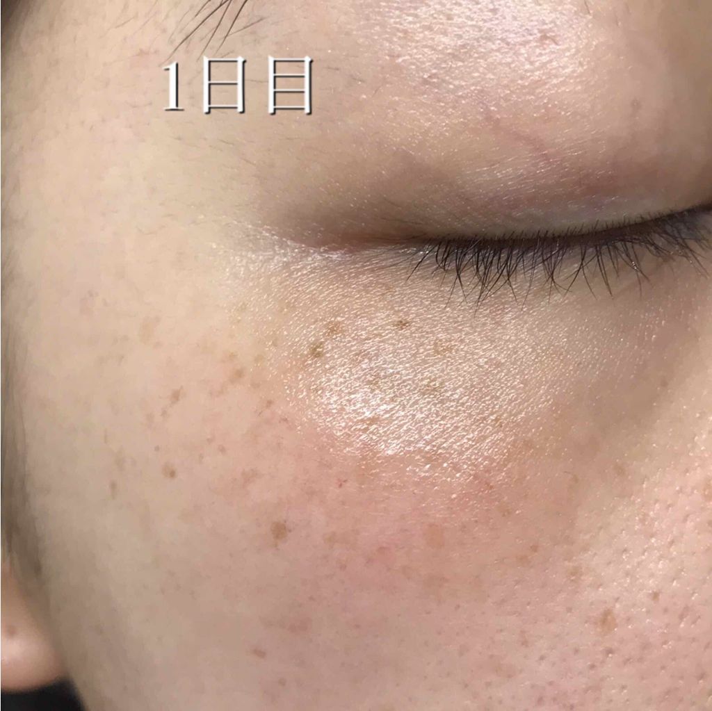 敏感肌用薬用美白美容液/無印良品/美容液を使ったクチコミ(2枚目)