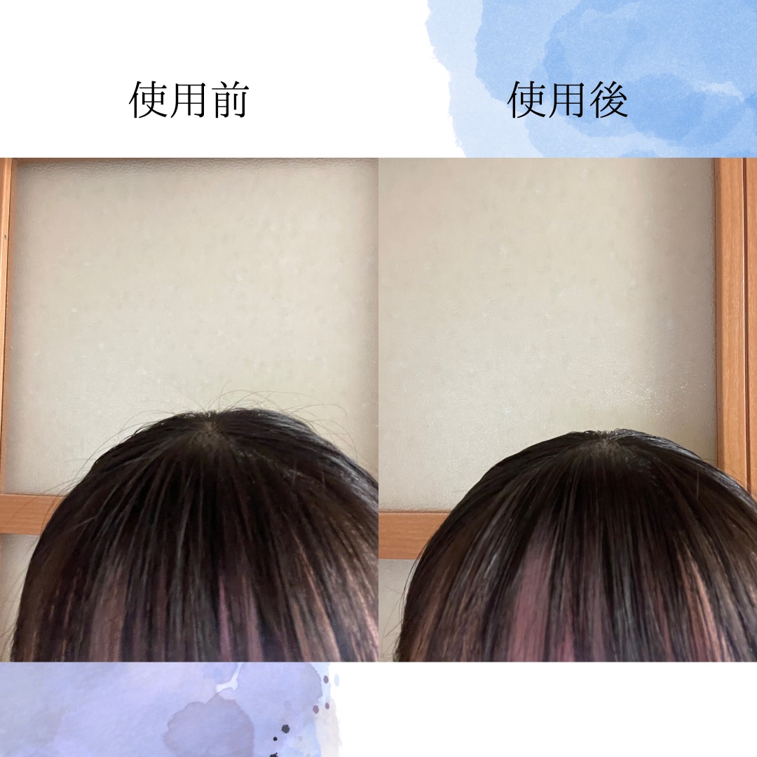 SS ビオリス ボタニカル ポイント ヘアスティック/SSビオリス/ヘアジェルを使ったクチコミ（3枚目）