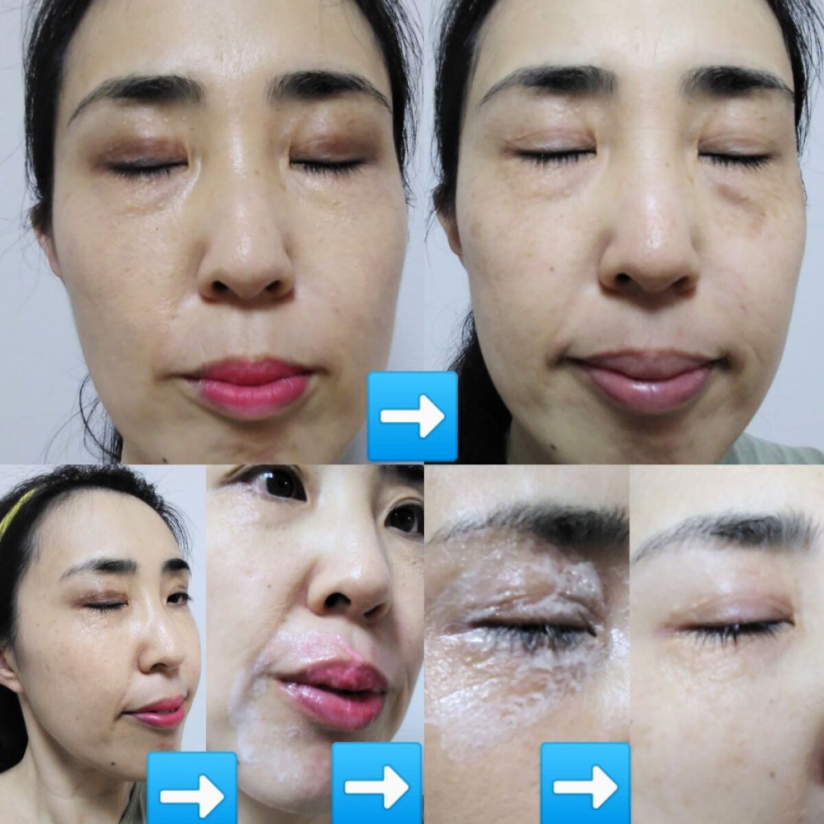 クレンジングジェルクレンザー/amorior/クレンジングジェルを使ったクチコミ(2枚目)