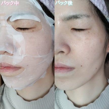 潤浸保湿 モイストリペアシートマスク/キュレル/シートマスク・パックを使ったクチコミ(10枚目)