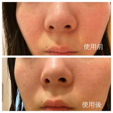 スーパーヴォルカニック ポア クレイマスク/innisfree/洗い流すパック・マスクを使ったクチコミ(2枚目)