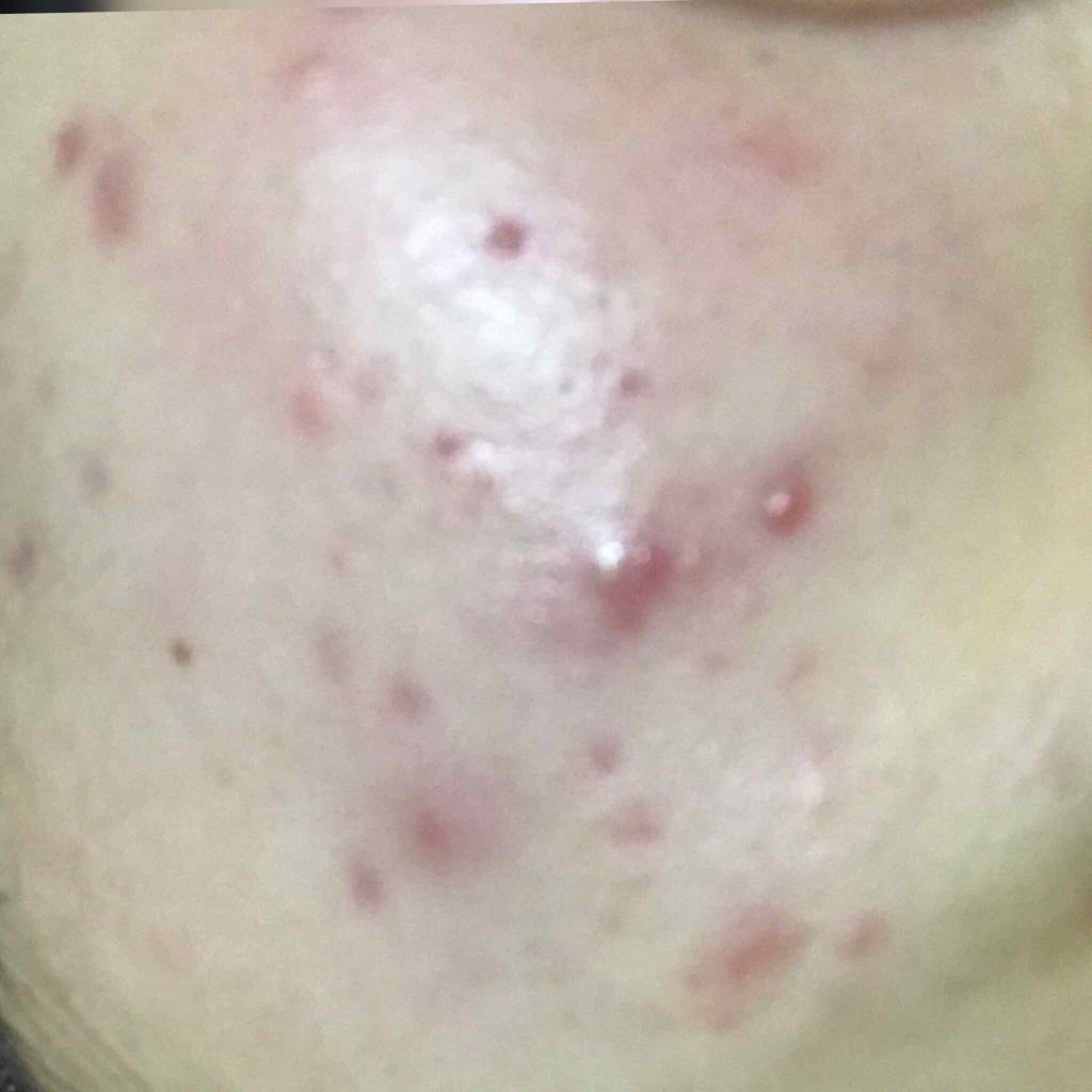 プロステージ VC100 ビタミンC モイスチャーローションリッチ/ナチュリア/化粧水を使ったクチコミ(2枚目)