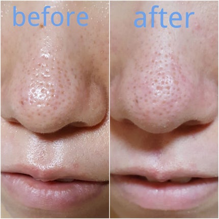 ドット・ウォッシー洗顔石鹸/ペリカン石鹸/洗顔石鹸を使ったクチコミ(2枚目)