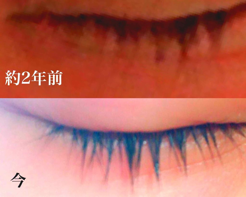 ローヤルゼリー配合 栄養ローション/DAISO/美容液を使ったクチコミ(1枚目)